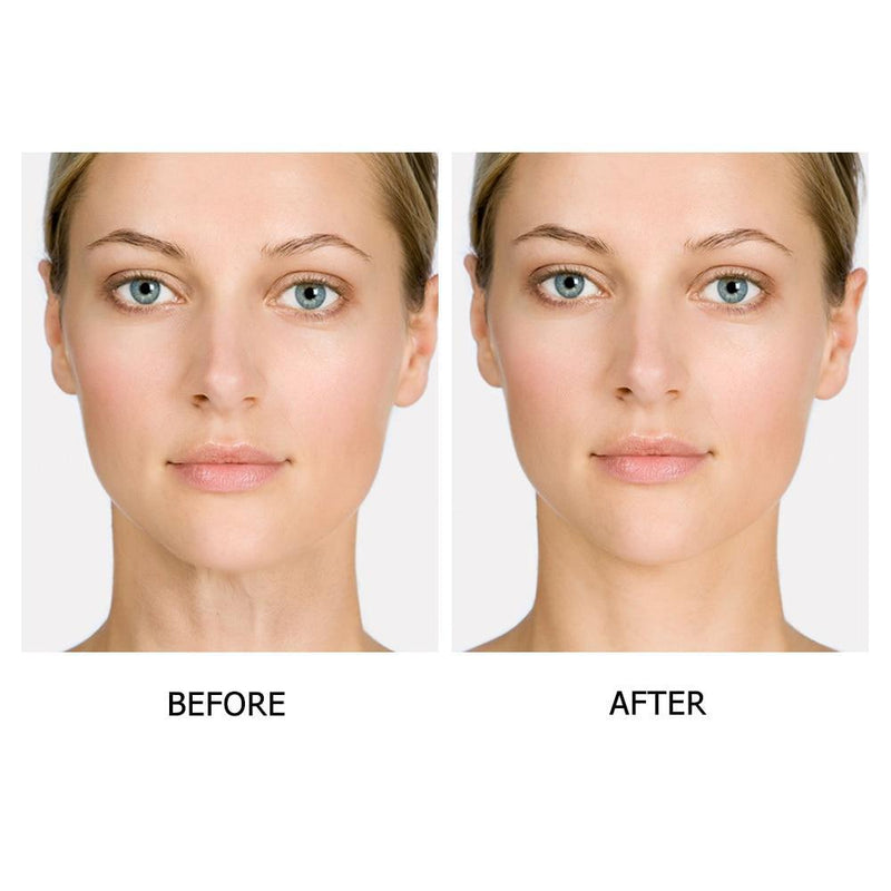 Adesivo de Silicone Anti Rugas - Reutilizável - Feminiky